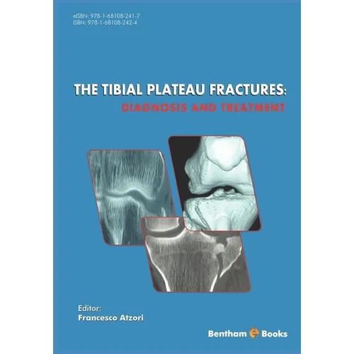The Tibial Plateau Fractures: Diagnosis and Treatmment