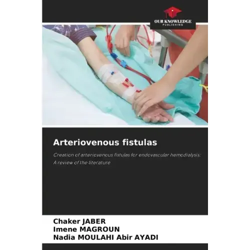 Arteriovenous fistulas