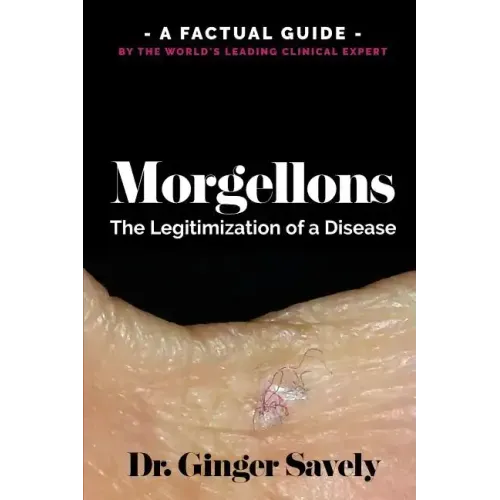 Morgellons: The legitimization of a disease: A Factual Guide by the World's Leading Clinical Expert