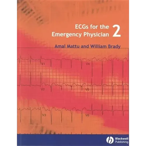 Ecgs for the Emergency Physician 2