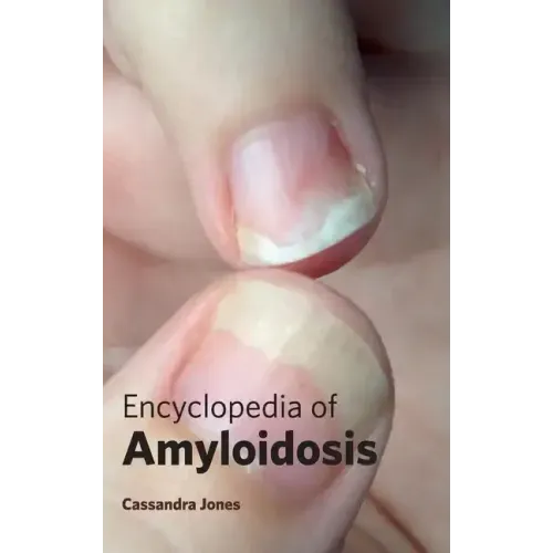 Encyclopedia of Amyloidosis
