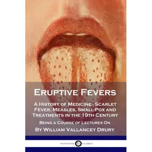 Eruptive Fevers: A History of Medicine - Scarlet Fever, Measles, Small-Pox and Treatments in the 19th Century - Being a Course of Lectures On