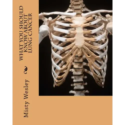 What you should know about Lung Cancer