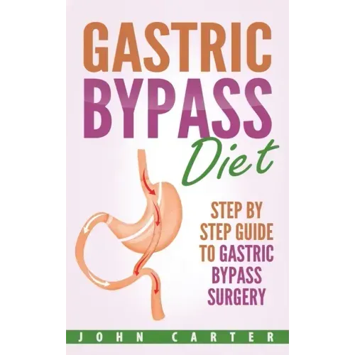 Gastric Bypass Diet: Step By Step Guide to Gastric Bypass Surgery