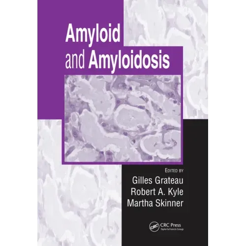 Amyloid and Amyloidosis