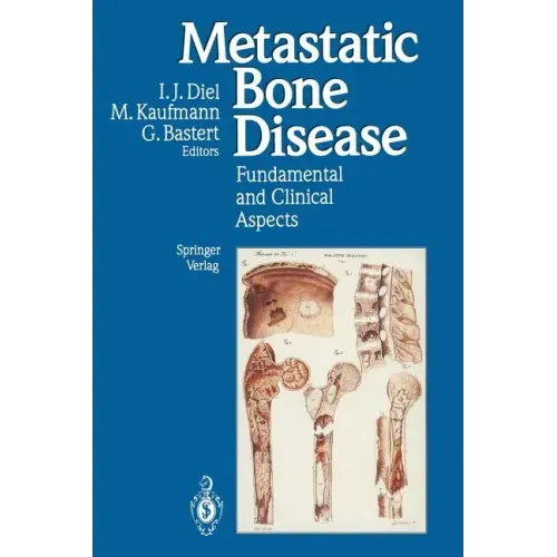Metastatic Bone Disease: Fundamental and Clinical Aspects - Paperback