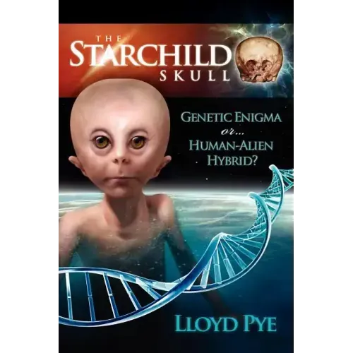 The Starchild Skull -- Genetic Enigma or Human-Alien Hybrid?