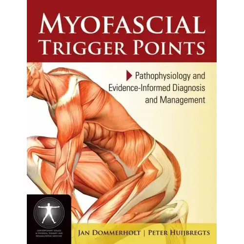 Myofascial Trigger Points: Pathophysiology and Evidence-Informed Diagnosis and Management: Pathophysiology and Evidence-Informed Diagnosis and Managem