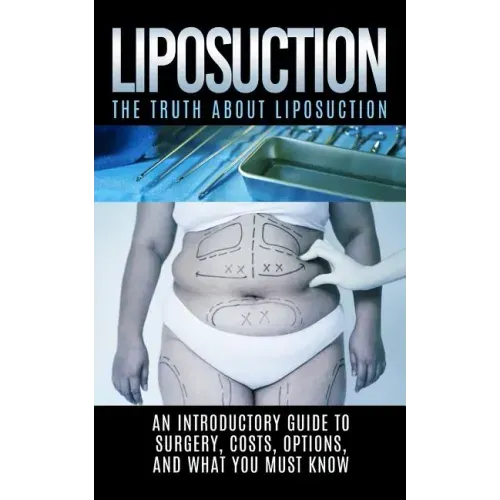 Liposuction: The Truth About Liposuction: An Introductory Guide to Surgery, Costs, Options, And What You Must Know