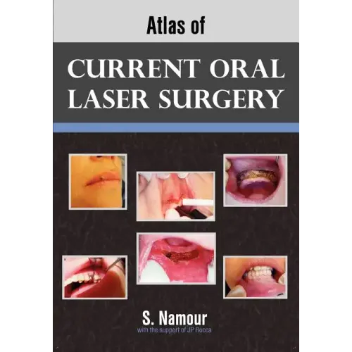 Atlas of Current Oral Laser Surgery