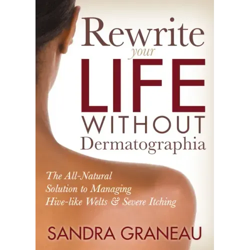 Rewrite Your Life Without Dermatographia: The All-Natural Solution to Managing Hive-Like Welts and Severe Itching