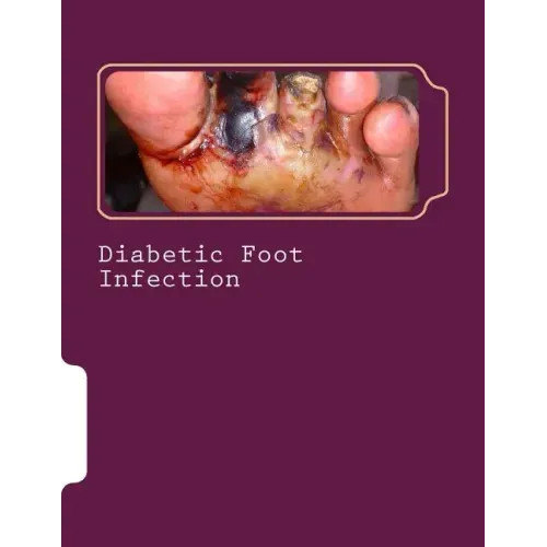 Diabetic Foot Infection - Paperback