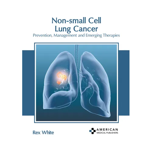 Non-Small Cell Lung Cancer: Prevention, Management and Emerging Therapies