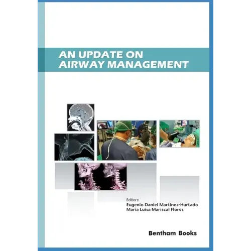 An Update on Airway Management