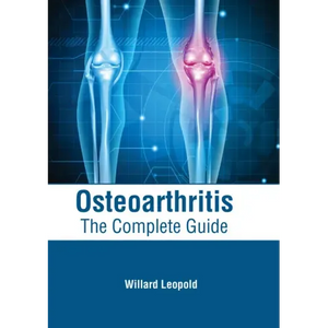 Osteoarthritis: The Complete Guide - Hardcover