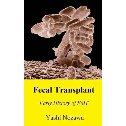 Fecal Transplant: Early History of FMT