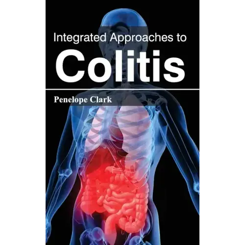 Integrated Approaches to Colitis