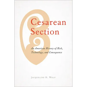 Cesarean Section: An American History of Risk, Technology, and Consequence - Paperback