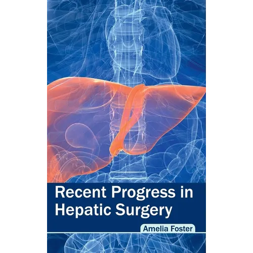 Recent Progress in Hepatic Surgery