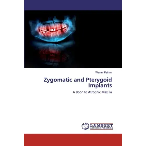 Zygomatic and Pterygoid Implants