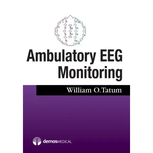 Ambulatory Eeg Monitoring