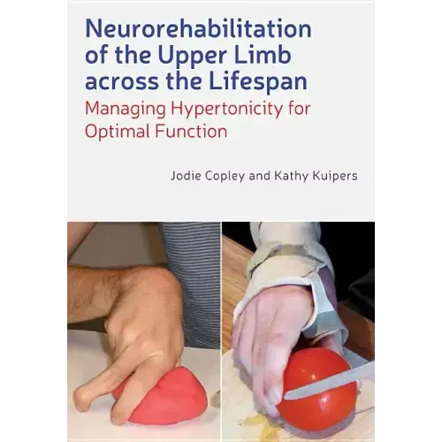 Neurorehabilitation of the Upper Limb Across the Lifespan - Paperback