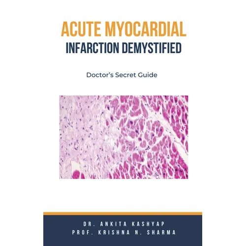 Acute Myocardial Infarction Demystified: Doctor's Secret Guide