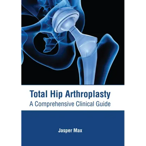 Total Hip Arthroplasty: A Comprehensive Clinical Guide - Hardcover