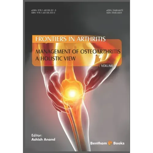 Management of Osteoarthritis - a Holistic View, (Frontiers in Arthritis, Volume 1)
