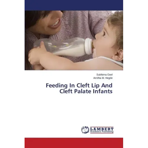 Feeding In Cleft Lip And Cleft Palate Infants