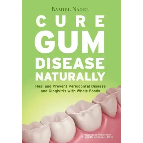 Cure Gum Disease Naturally: Heal Gingivitis and Periodontal Disease with Whole Foods - Paperback