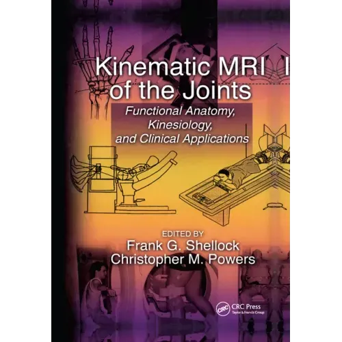 Kinematic MRI of the Joints