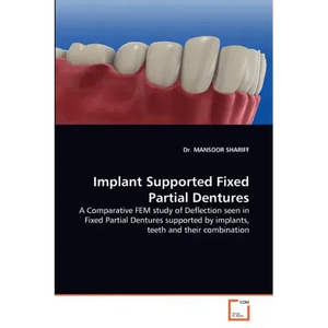 Implant Supported Fixed Partial Dentures - Paperback