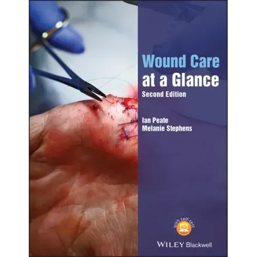 Wound Care at a Glance, Second Edition