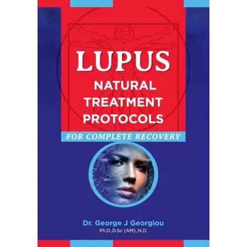 Lupus: Natural Treatment Protocols for Complete Recovery