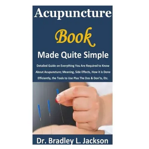 Acupuncture Book Made Quite Simple: Detailed Guide on Everything You Are Required to Know About Acupuncture; Meaning, Side Effects, How it is Done Eff - Paperback