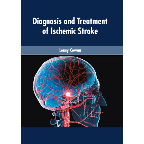 Diagnosis and Treatment of Ischemic Stroke