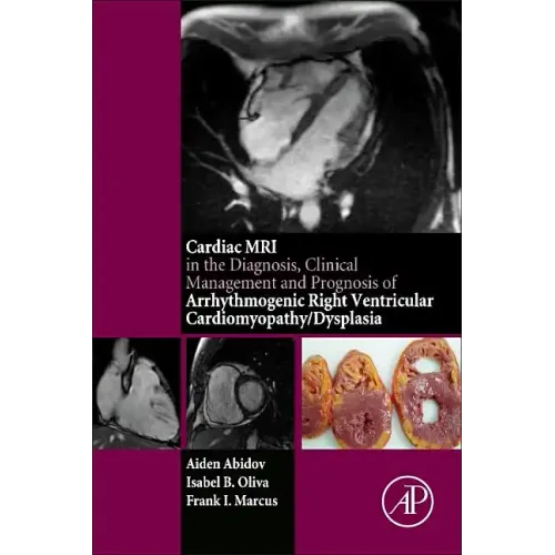 Cardiac MRI in Diagnosis, Clinical Management, and Prognosis of Arrhythmogenic Right Ventricular Cardiomyopathy/Dysplasia