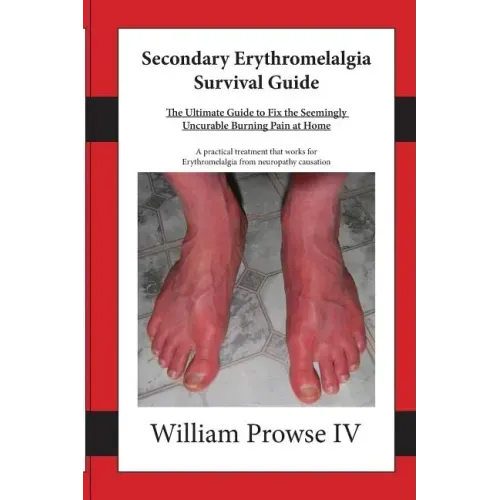 Secondary Erythromelalgia Survival Guide