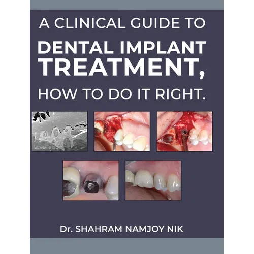 A clinical guide to dental implant treatment, how to do it right.