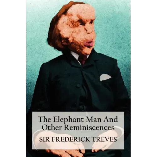 The Elephant Man and Other Reminiscences