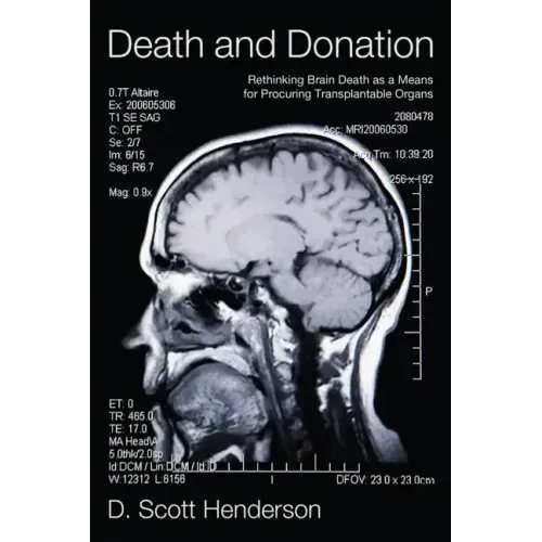 Death and Donation: Rethinking Brain Death as a Means for Procuring Transplantable Organs