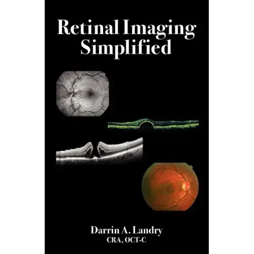 Retinal Imaging Simplified