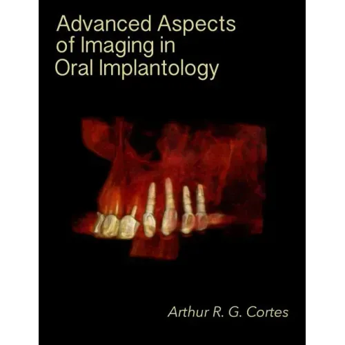 Advanced Aspects of Imaging in Oral Implantology