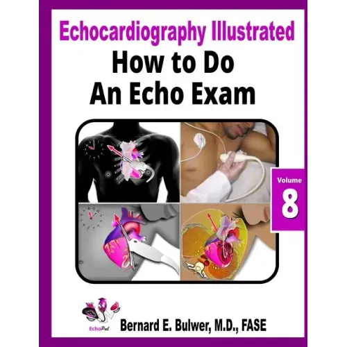 How to Do an Echo Exam