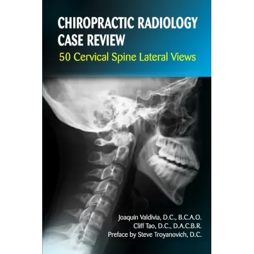 Chiropractic Radiology Case Review: 50 Cervical Spine Lateral Views