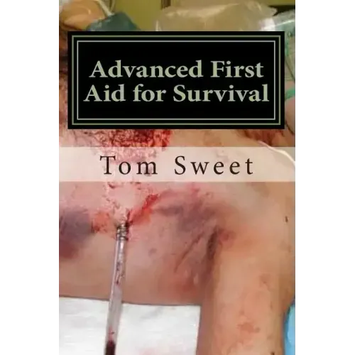 Advanced First Aid for Survival: When the Sh*t Hits the Fan YOU Are the Docotr