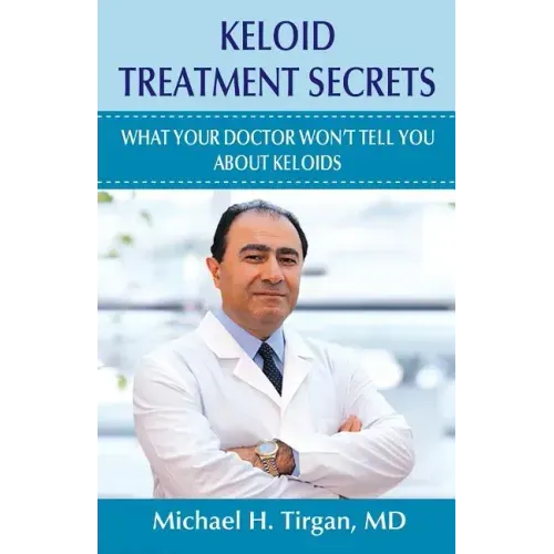 Keloid Treatment Secrets: What Your Doctor Wont Tell You.