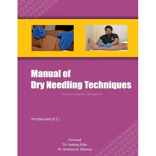 Manual of Dry Needling Techniques