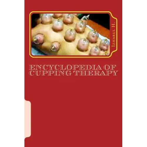 Encyclopedia of Cupping Therapy: Al-Hijama
